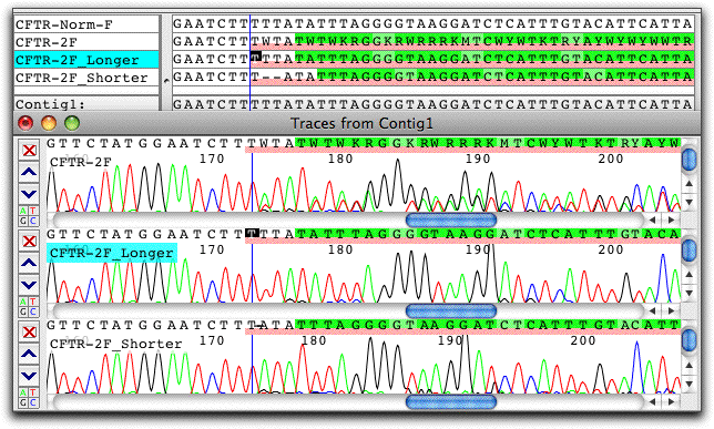 heterozygous indel splitting into shorter and longer pseudo-alleles